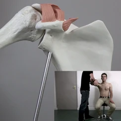 Cliquez pour en savoir plus sur le SCAPULEO
