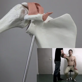 Cliquez sur l'image pour en savoir plus sur le SCAPULEO